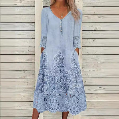 Nextmacys™ Lace Button-Down Midi Dress